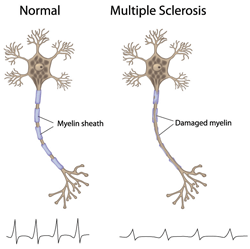 Illustration of two nerve cells